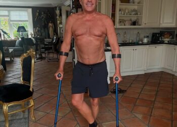 Gerard Joling zwaar toegetakeld na incident