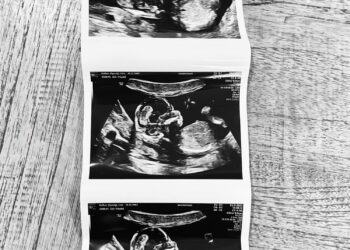 Deze musicalster brengt prachtig baby nieuws