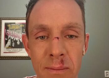 Pijnlijke update van John de Bever na pijnlijke val van Kees