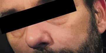 Ex-bassist hoeft niet terug de gevangenis in na kinderpornozaak